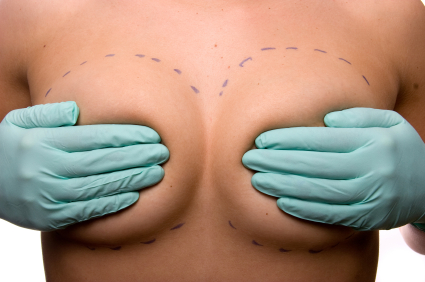Breast-augmentation1